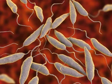 Leishmaniose
